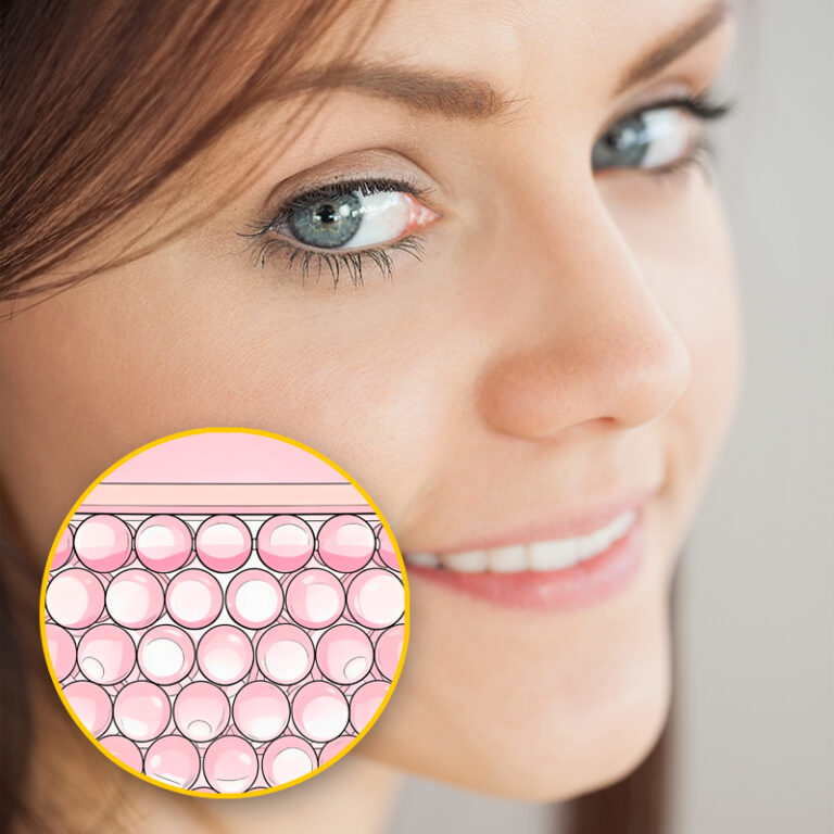 Zona periocular invierno